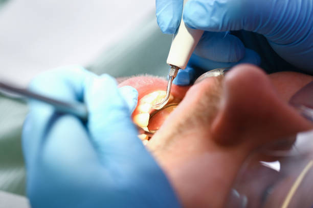 Professional Emergency Dental Service in PA